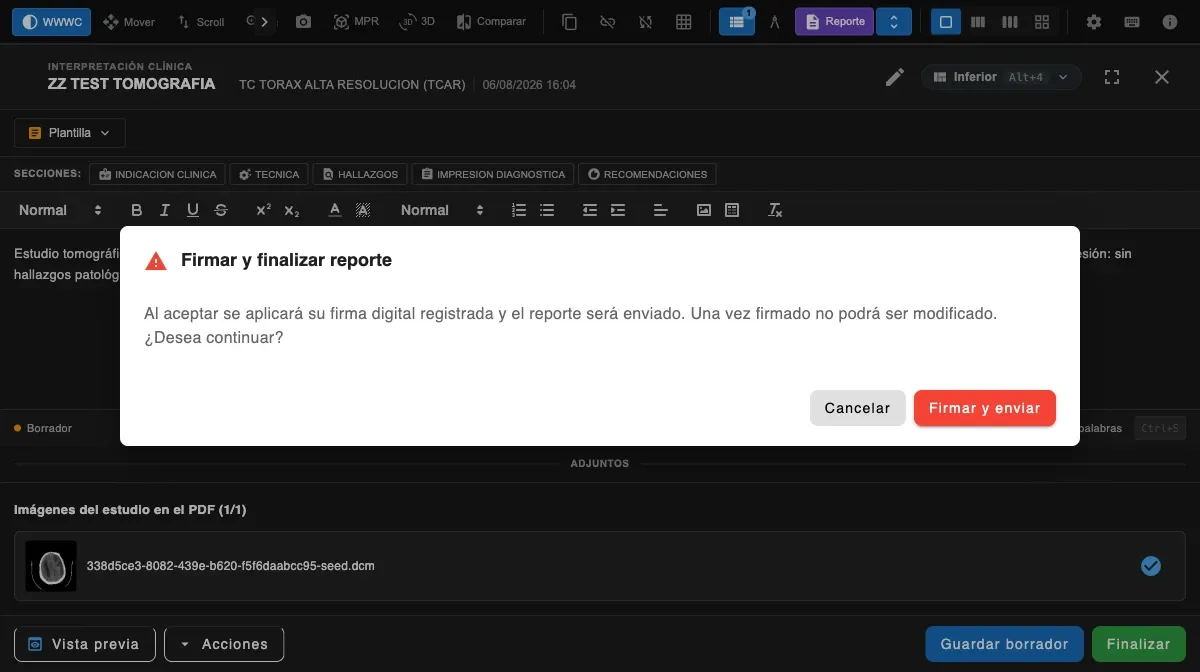 Pantalla de LumenView para firmar el informe del estudio.